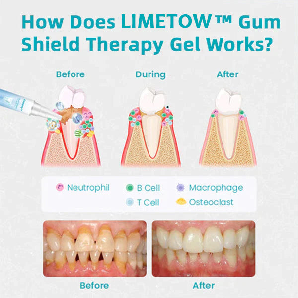 LIMETOW™ Gum Shield Therapy Gel 🔥Last Day Promotion 70% OFF🔥