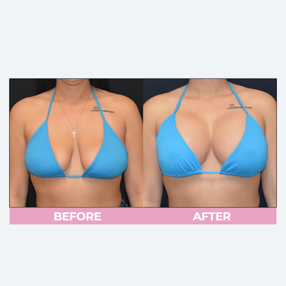 LIMETOW™ Breast Enhance Cream