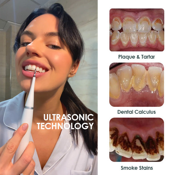 LIMETOW™ Ultrasonic Tooth Cleaner